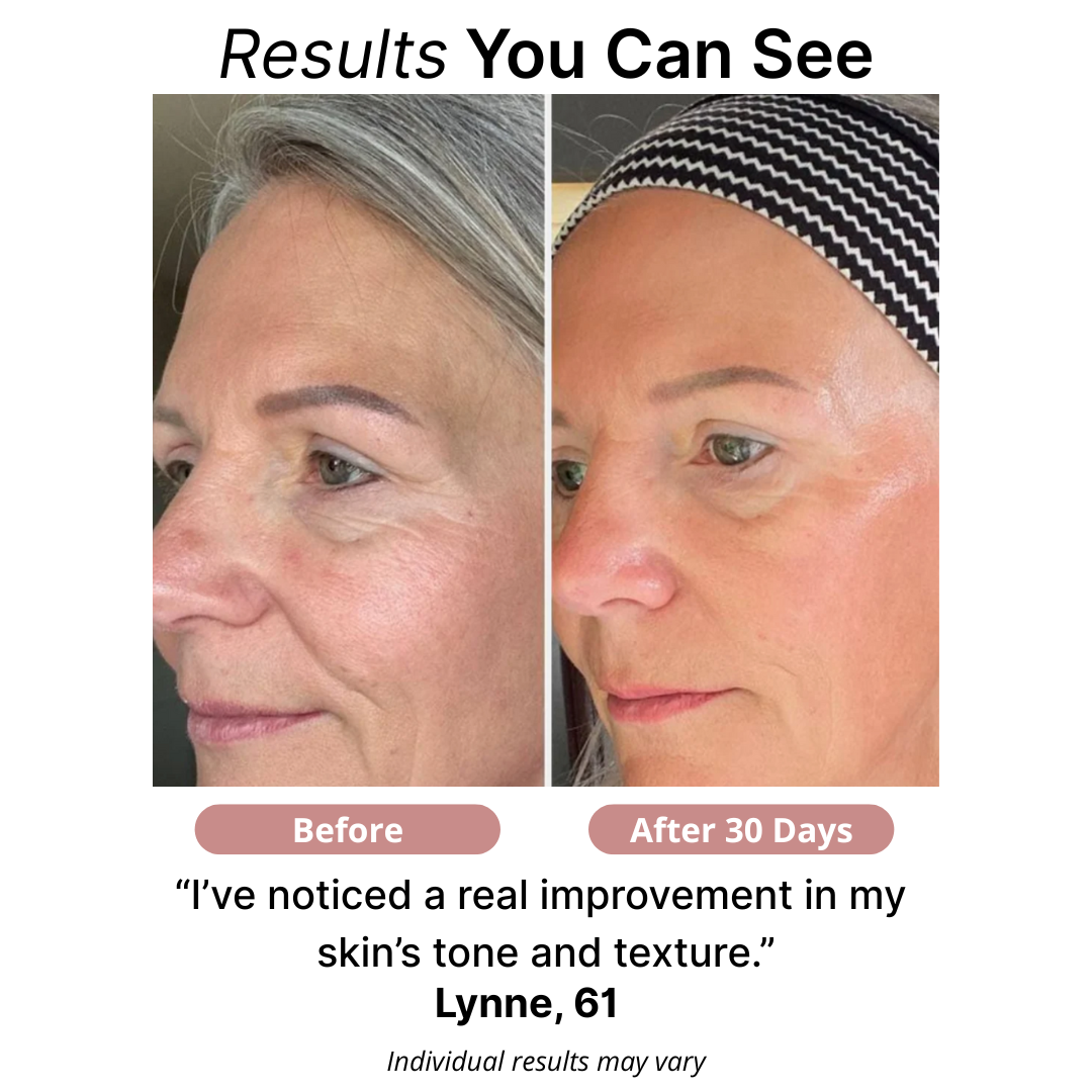 Iride® Bio-Collagen Face Mask