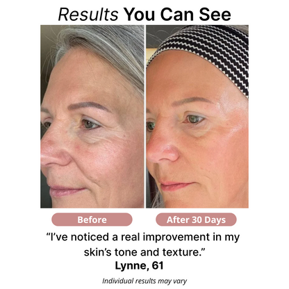 Iride® Bio-Collagen Face Mask