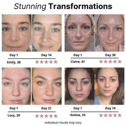 Iride® Bio-Collagen Face Mask